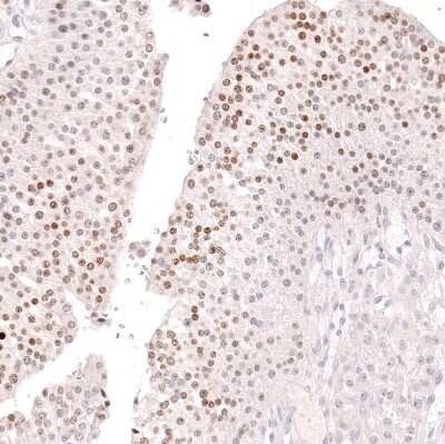 Immunohistochemistry-Paraffin: FOXL2 Antibody (CL12762) [NBP3-18544]