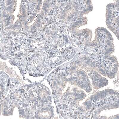 Immunohistochemistry-Paraffin: FOXL2 Antibody (CL12762) [NBP3-18544]