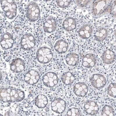 Immunohistochemistry-Paraffin: FOXL2 Antibody (CL12762) [NBP3-18544]