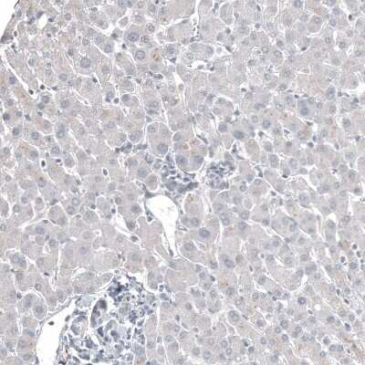 Immunohistochemistry-Paraffin: FOXL2 Antibody (CL12762) [NBP3-18544]