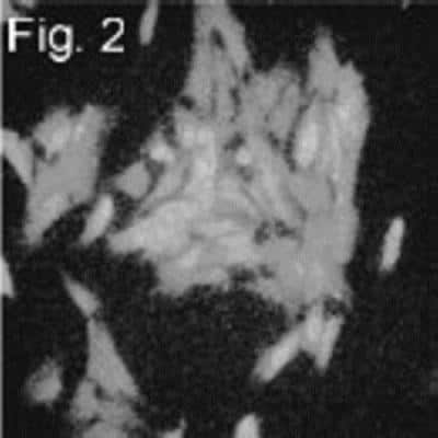 Immunocytochemistry/ Immunofluorescence: FOXL2 Antibody [NBP2-22473]