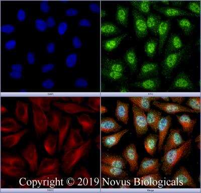 Immunocytochemistry/ Immunofluorescence: FOXL2 Antibody - BSA Free [NBP2-70013]
