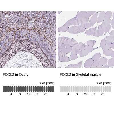 Immunohistochemistry-Paraffin: FOXL2 Antibody [NBP2-49608]