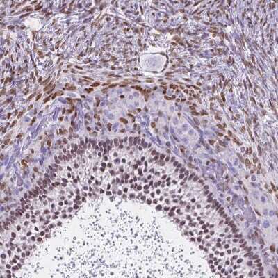 Immunohistochemistry-Paraffin: FOXL2 Antibody [NBP2-49608]