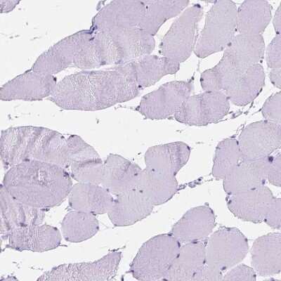 Immunohistochemistry-Paraffin: FOXL2 Antibody [NBP2-49608]
