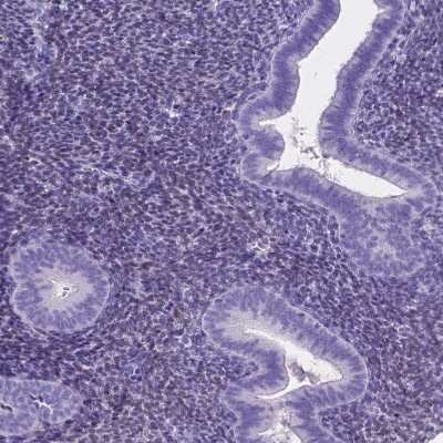 Immunohistochemistry-Paraffin: FOXL2 Antibody [NBP2-49608]