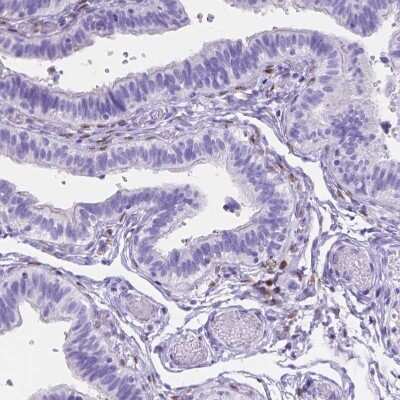 Immunohistochemistry-Paraffin: FOXL2 Antibody [NBP2-49608]