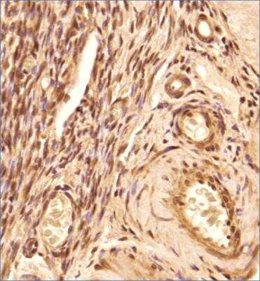 Immunohistochemistry-Paraffin: FOXL2 Antibody - BSA Free [NBP2-70013]