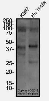 Western Blot: FOXL2 AntibodyBSA Free [NBP2-70013]