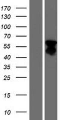 Western Blot: FOXL2 Overexpression Lysate [NBP2-06384]