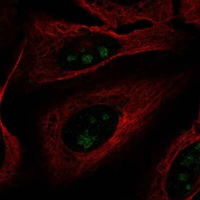 Immunocytochemistry/ Immunofluorescence: FOXL2NB Antibody [NBP2-57780]