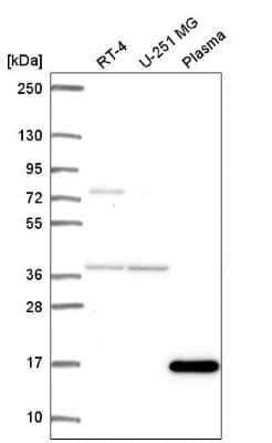 Western Blot: FOXL2NB Antibody [NBP2-57587]