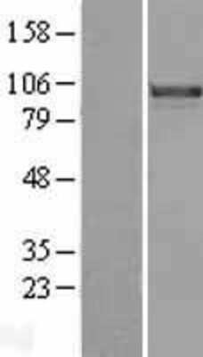 Western Blot: FoxM1 Overexpression Lysate [NBL1-10809]