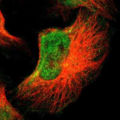 Immunocytochemistry/ Immunofluorescence: FOXN2 Antibody [NBP1-83153]