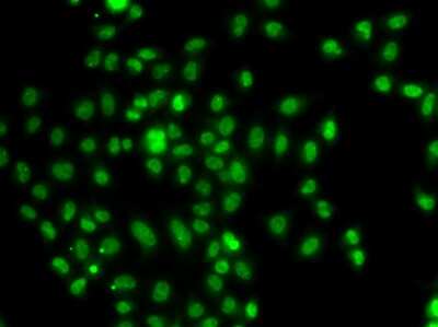 Immunocytochemistry/ Immunofluorescence: FOXN2 Antibody - BSA Free [NBP3-04785]