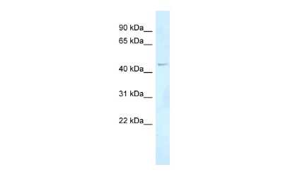 Western Blot: FOXN2 Antibody [NBP2-82826]