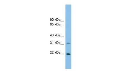 Western Blot: FOXN2 Antibody [NBP2-82834]