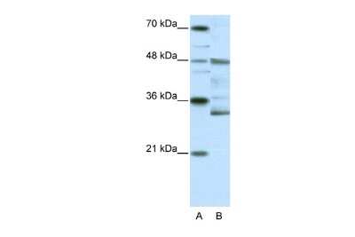 Western Blot: FOXN2 Antibody [NBP2-82835]