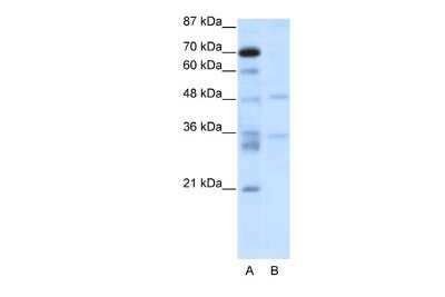 Western Blot: FOXN2 Antibody [NBP2-82836]