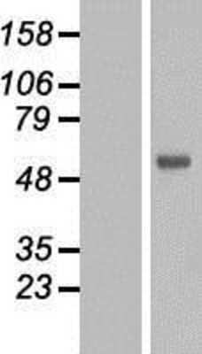 Western Blot: FOXN2 Overexpression Lysate [NBL1-10811]