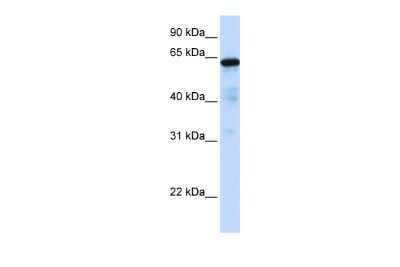 Western Blot: FOXN4 Antibody [NBP3-09250]