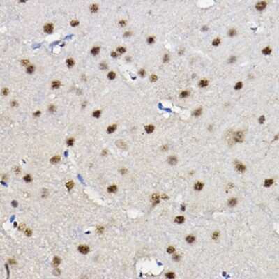 Immunohistochemistry-Paraffin: FOXO1A/3/4 Antibody - Azide and BSA Free [NBP3-05667]