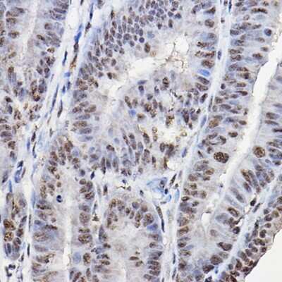 Immunohistochemistry-Paraffin: FOXO1A/3/4 Antibody - Azide and BSA Free [NBP3-05667]