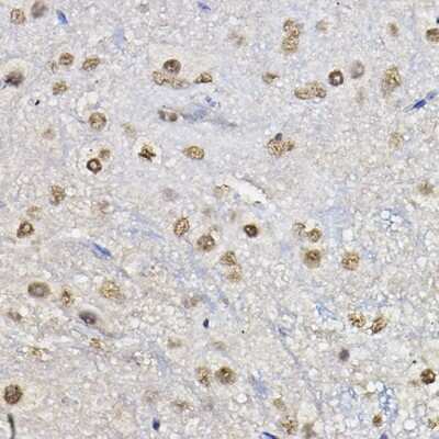 Immunohistochemistry-Paraffin: FOXO1A/3/4 Antibody - Azide and BSA Free [NBP3-05667]