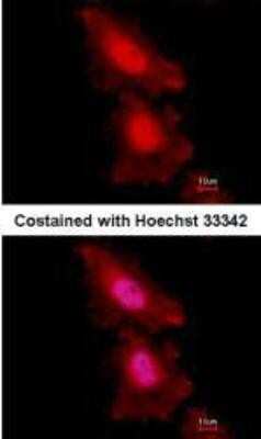 Immunocytochemistry/ Immunofluorescence: FoxO1/FKHR Antibody (7H3) [NB200-307]