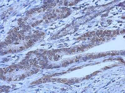 Immunohistochemistry-Paraffin: FoxO1/FKHR Antibody (7H3) [NB200-307]
