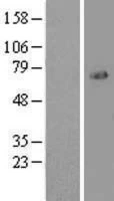 Western Blot: FoxO1/FKHR Overexpression Lysate [NBL1-10813]