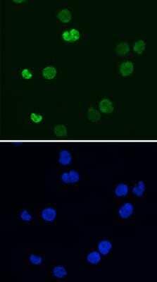 Immunocytochemistry/ Immunofluorescence: FOXO3 Antibody [NB100-614]