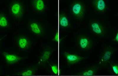 Immunocytochemistry/ Immunofluorescence: FOXO3 Antibody [NBP2-16521]