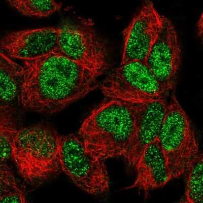 Immunocytochemistry/ Immunofluorescence: FOXO3 Antibody [NBP2-55691]