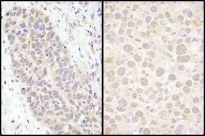 Immunohistochemistry: FOXO3 Antibody [NB100-613]