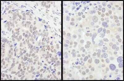 Immunohistochemistry-Paraffin: FOXO3 Antibody [NB100-614]
