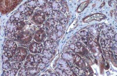 Immunohistochemistry-Paraffin: FOXO3 Antibody [NBP2-16521]