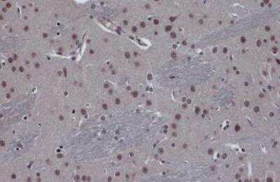Immunohistochemistry-Paraffin: FOXO3 Antibody [NBP2-16521]
