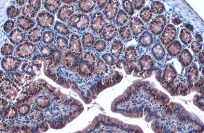Immunohistochemistry-Paraffin: FOXO3 Antibody [NBP2-16521]