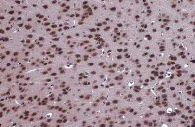 Immunohistochemistry-Paraffin: FOXO3 Antibody [NBP2-16521]