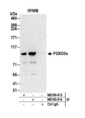 Immunoprecipitation: FOXO3 Antibody [NB100-613]