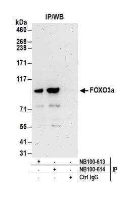 Immunoprecipitation: FOXO3 Antibody [NB100-614]