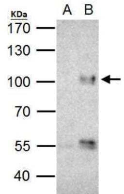 Immunoprecipitation: FOXO3 Antibody [NBP2-16521]