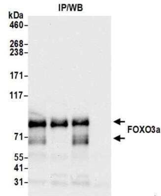 Immunoprecipitation: FOXO3 Antibody (BLR140H) [NBP3-14720]