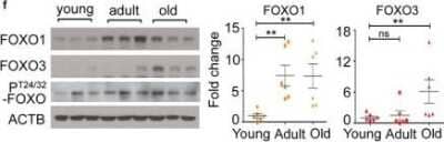 Western Blot: FOXO3 Antibody [NB100-614]