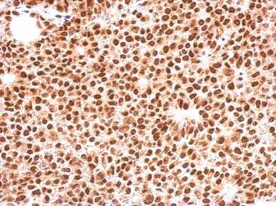 Immunohistochemistry-Paraffin: FOXO3 Antibody [NBP2-16521]