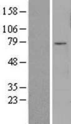 Western Blot: FOXO3 Overexpression Lysate [NBL1-10814]