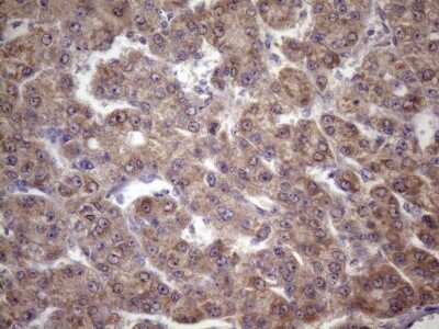 Immunohistochemistry: FOXO4 Antibody (OTI1A4) [NBP2-45712]