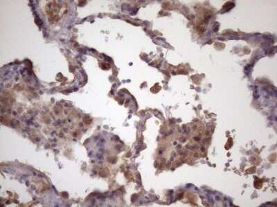 Immunohistochemistry: FOXO4 Antibody (OTI1A4) [NBP2-45712]
