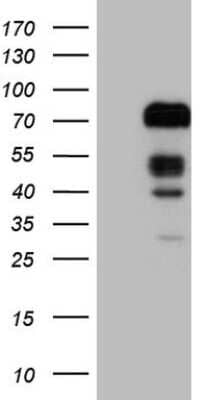 Western Blot: FOXO4 Antibody (OTI1A4) [NBP2-45712]